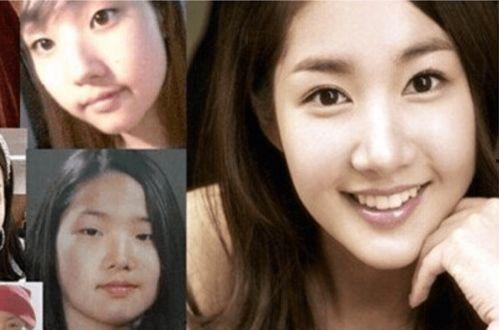 整容成功明星,揭秘整容成功明星的蜕变之路