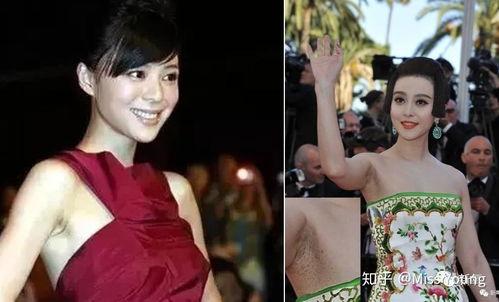 明星如何脱毛,明星们的脱毛技巧大揭秘